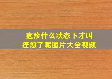 疱疹什么状态下才叫痊愈了呢图片大全视频