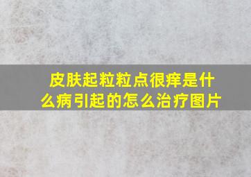 皮肤起粒粒点很痒是什么病引起的怎么治疗图片