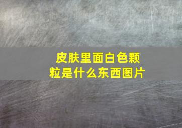 皮肤里面白色颗粒是什么东西图片