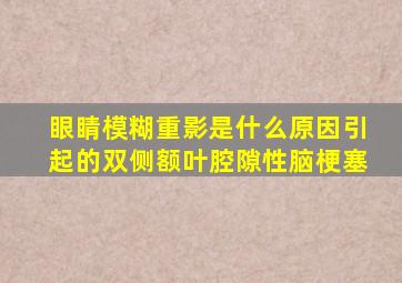 眼睛模糊重影是什么原因引起的双侧额叶腔隙性脑梗塞