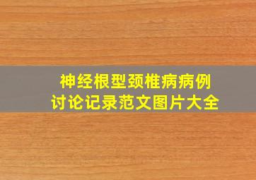 神经根型颈椎病病例讨论记录范文图片大全