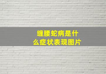 缠腰蛇病是什么症状表现图片