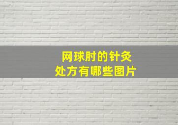 网球肘的针灸处方有哪些图片