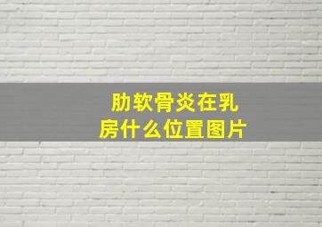 肋软骨炎在乳房什么位置图片