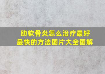 肋软骨炎怎么治疗最好最快的方法图片大全图解