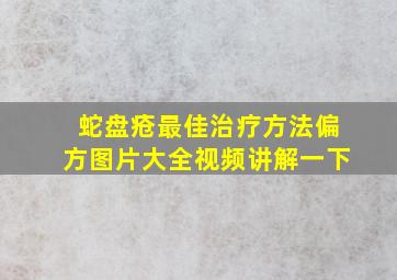 蛇盘疮最佳治疗方法偏方图片大全视频讲解一下