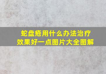 蛇盘疮用什么办法治疗效果好一点图片大全图解