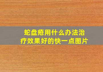 蛇盘疮用什么办法治疗效果好的快一点图片