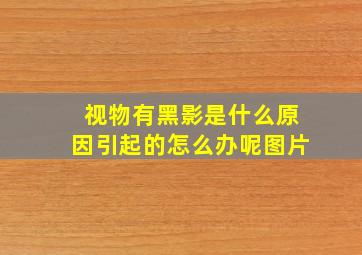 视物有黑影是什么原因引起的怎么办呢图片