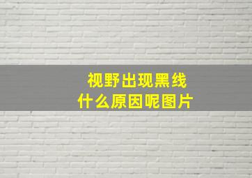 视野出现黑线什么原因呢图片