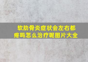 软肋骨炎症状会左右都疼吗怎么治疗呢图片大全