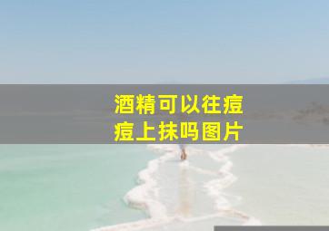 酒精可以往痘痘上抹吗图片