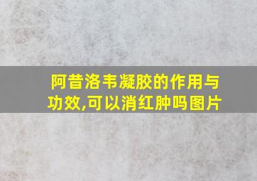 阿昔洛韦凝胶的作用与功效,可以消红肿吗图片