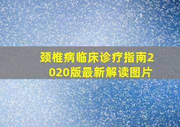 颈椎病临床诊疗指南2020版最新解读图片